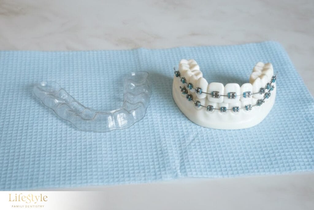 Invisalign aligners and traditional braces placed side by side on a dental table